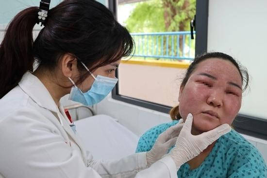 Người phụ nữ ở TPHCM nhập viện sau khi tự peel da tại nhà