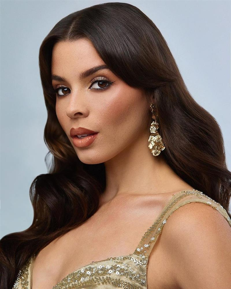 Hoa hậu Hoàn vũ Costa Rica mặt đầy tàn nhang-5