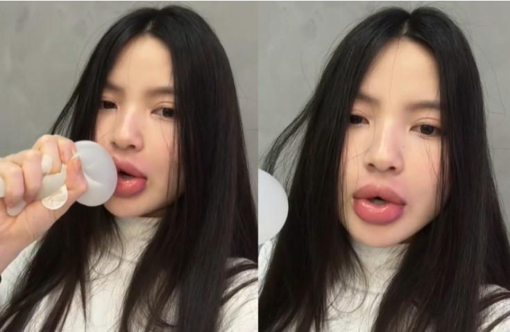 Vợ Quang Hải vội tiêm tan filler sau khi bị chồng chê-2