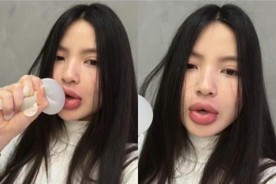 Vợ Quang Hải vội tiêm tan filler sau khi bị chồng chê