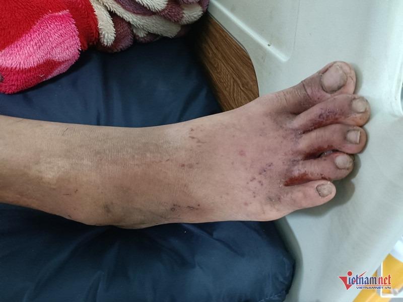 6 ngày kinh hoàng của thanh niên bị lũ cuốn trôi, mắc kẹt giữa sông ở Gia Lai-3