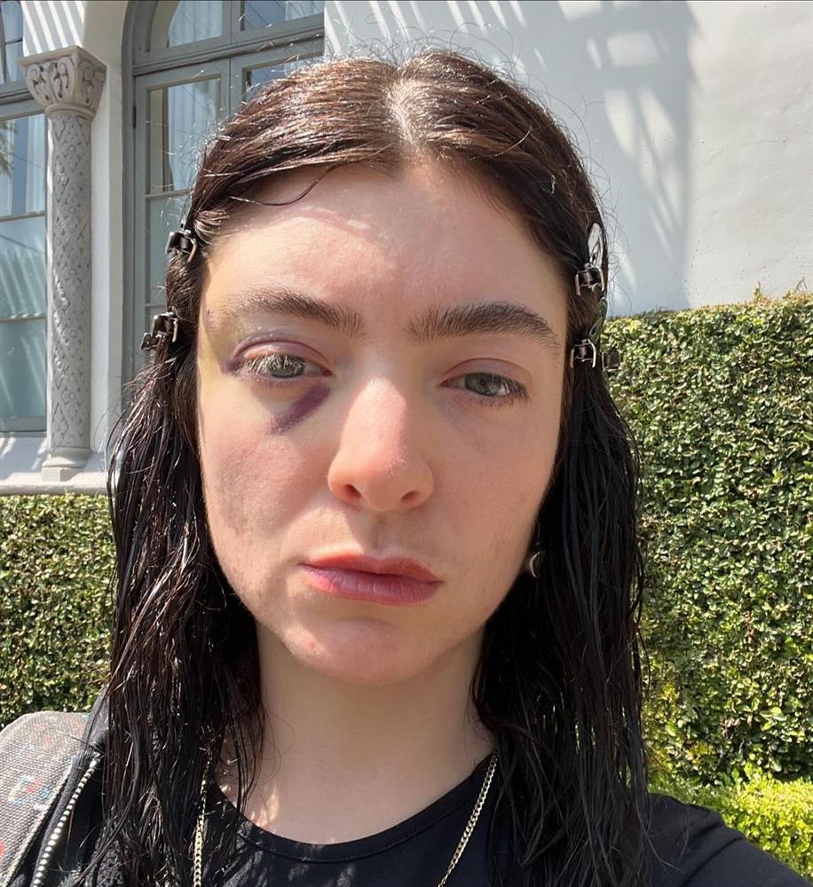 LORDE1.jpg