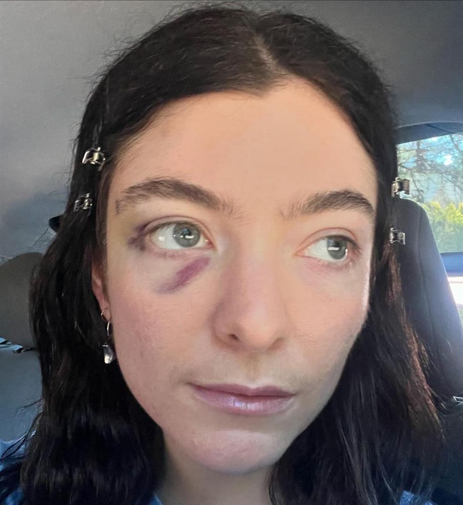 LORDE3.jpg