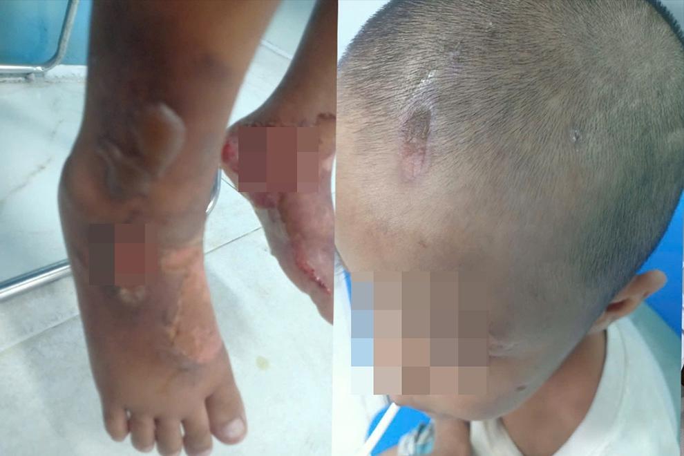 Không chịu làm đám cưới, thiếu nữ 18 tuổi bị cô ruột xởn tóc-2