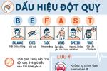 Những người dễ bị đột quỵ khi tập thể dục, thể thao-2