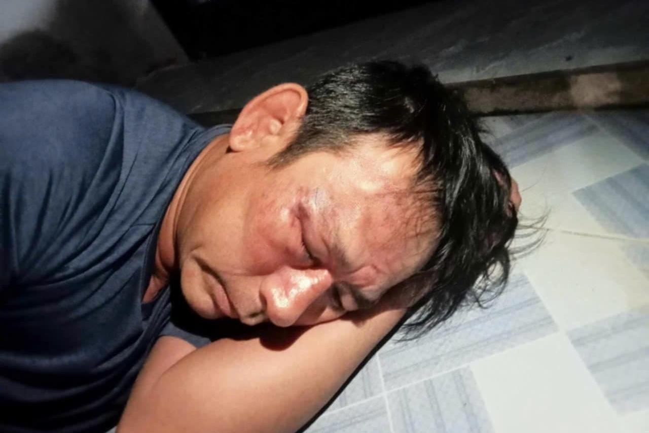 Ngăn bạn xô xát, nữ sinh ở Thanh Hóa bị đánh hội đồng gãy đốt sống cổ-2