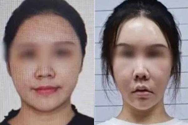 Người phụ nữ tử vong do phẫu thuật thẩm mỹ 6 lần trong một ngày-4