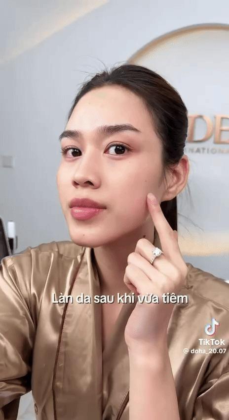 Hoa hậu Đỗ Thị Hà để lộ khuyết điểm nhan sắc ở tuổi 23-6