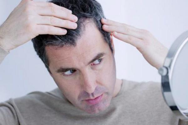 Những thói quen tưởng vô hại lại khiến tóc rụng đến hói đầu-4