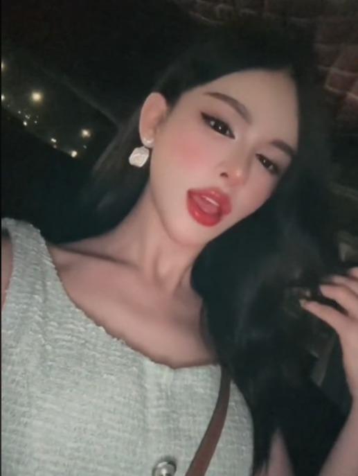 Không nhận ra Trần Đức Bo với diện mạo hoàn toàn mới sau phẫu thuật thẩm mỹ-4