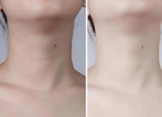 Lời khuyên cho phụ nữ trung niên: Đừng quá tằn tiện, muốn trẻ lâu hãy đầu tư nhiều hơn cho 4 điều này-2