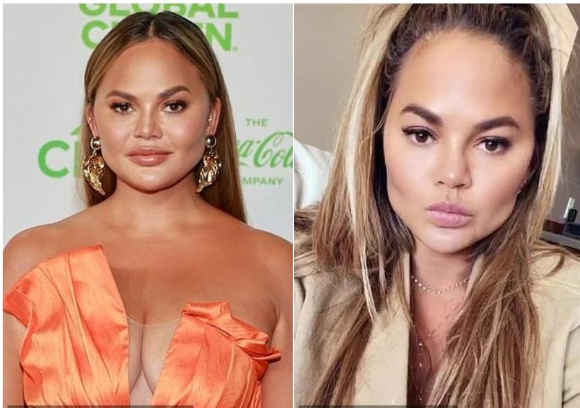 Trào lưu làm đẹp tự hủy ở showbiz-1