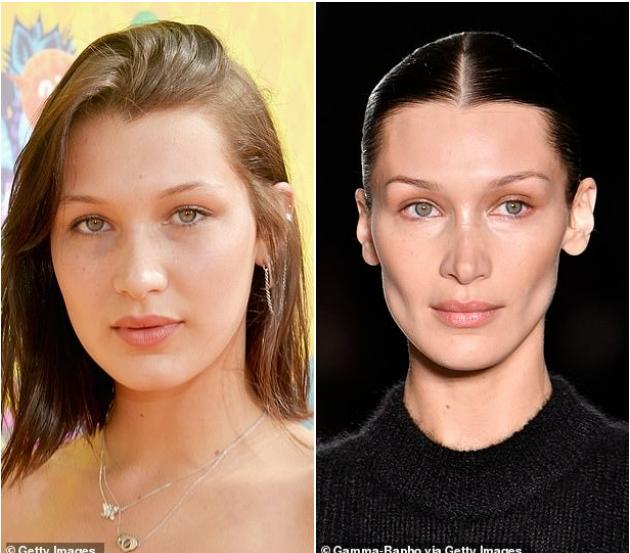 Trào lưu làm đẹp tự hủy ở showbiz-2