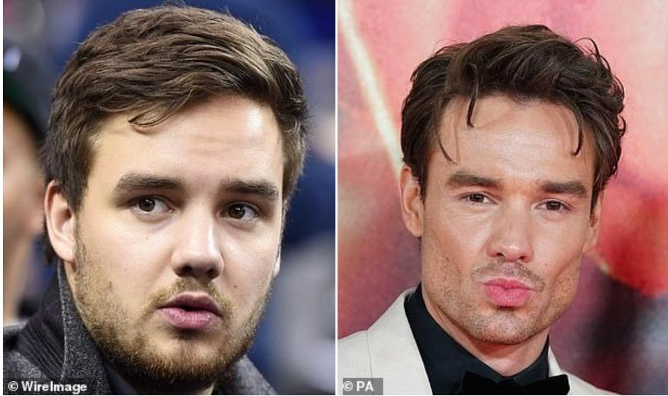 Trào lưu làm đẹp tự hủy ở showbiz-5