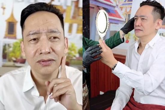 'Nối gót' đàn anh Ngọc Sơn, Duy Mạnh sửa 2 bộ phận trên mặt