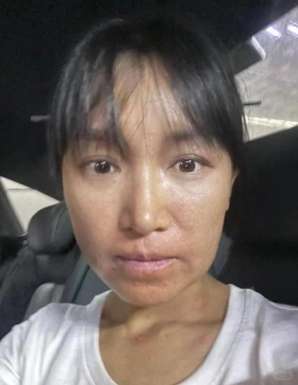 Lý Tử Thất xuất hiện sau bức ảnh gây sốc-4