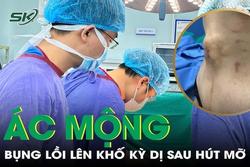 Ác mộng sống 7 tháng với khối kỳ dị lồi lên vùng bụng sau hút mỡ