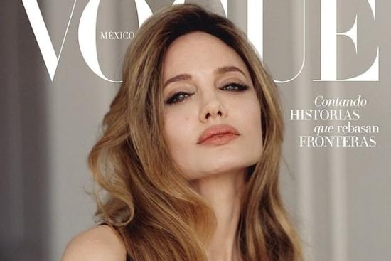 Bức ảnh gây tranh cãi của Angelina Jolie