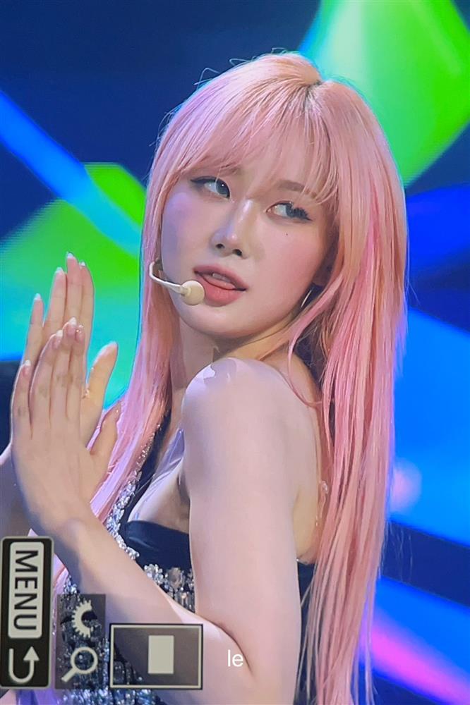 Gương mặt sưng phồng khác lạ của mỹ nhân Kpop-6