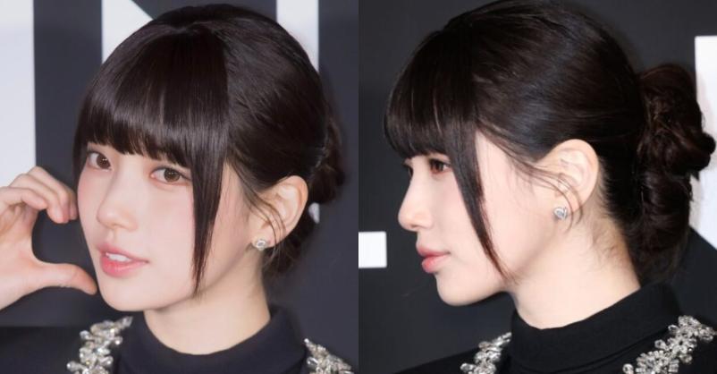 Suzy trải qua ca phẫu thuật nguy hiểm-2