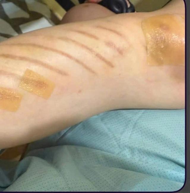 Phản ứng của Trấn Thành khi Hari Won gặp chấn thương-1