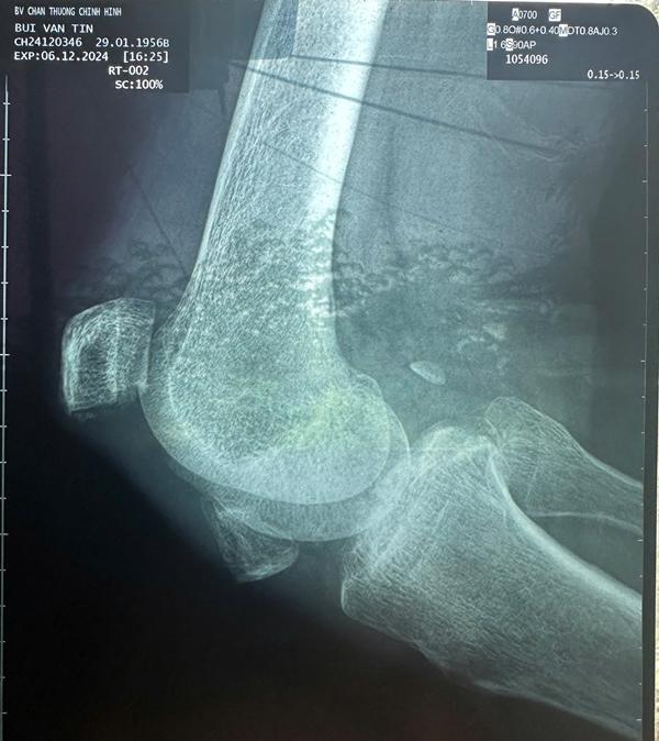 Thương Tín muốn được Tô Hiếu tiếp tục cưu mang và ở lại Sài Gòn-3