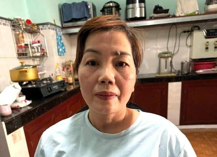 Bắt nhóm giả cảnh sát hình sự, trùm đầu tài xế ô tô Grab để cướp-2