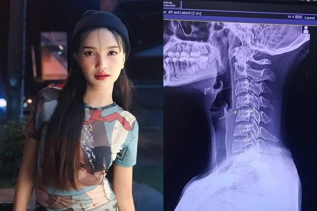 Kết quả khám nghiệm tử thi nữ ca sĩ 20 tuổi-2