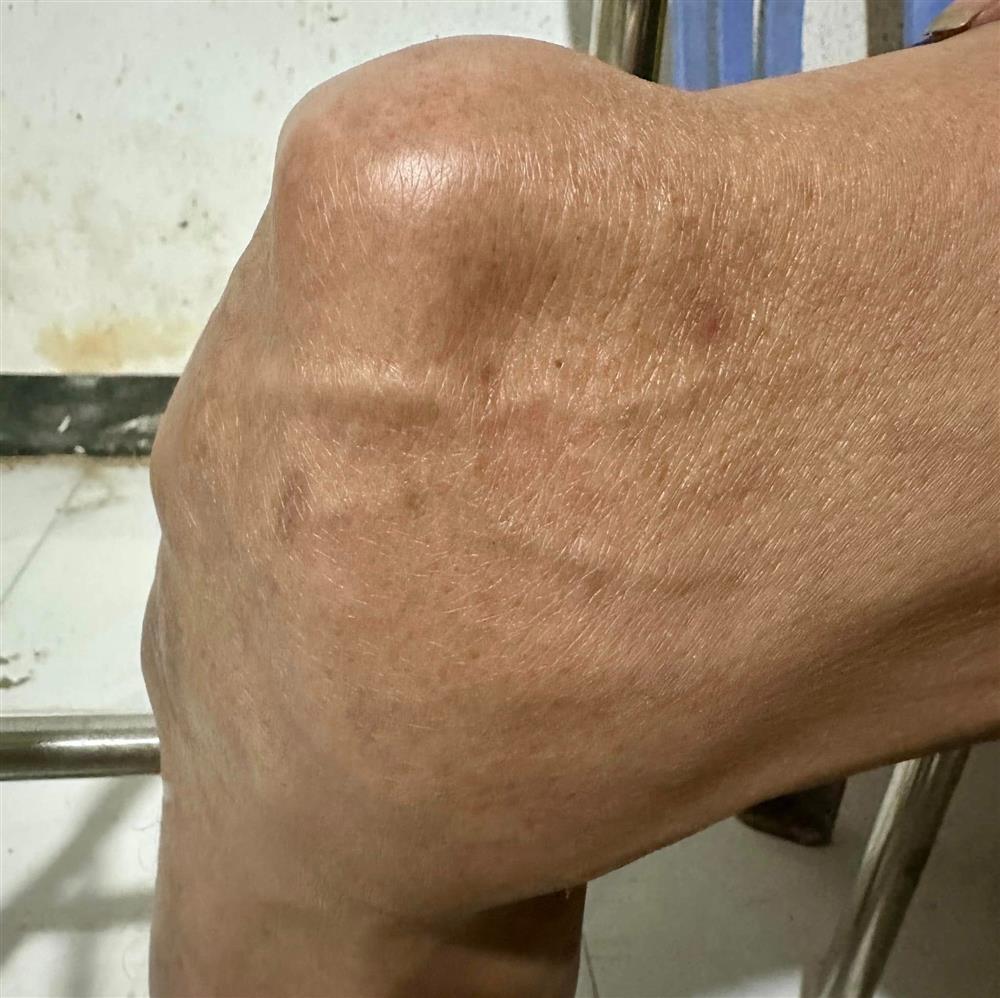 Phản ứng của vợ cũ Thương Tín khi biết tin nam nghệ sĩ nhập viện-4