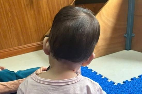 Sai lầm khiến trẻ bị vẹo cổ cha mẹ cần tránh