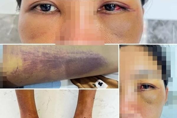 Ám ảnh của người phụ nữ bị gia đình chồng giam lỏng, ép ăn chất thải để trừ tà-2