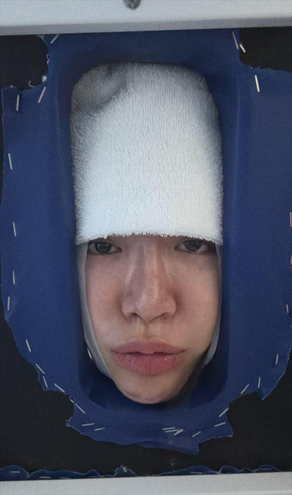 Sức khỏe báo động khiến Minh Tú chưa thể có em bé: Bị bệnh cột sống, thoái hóa và mất xương-2