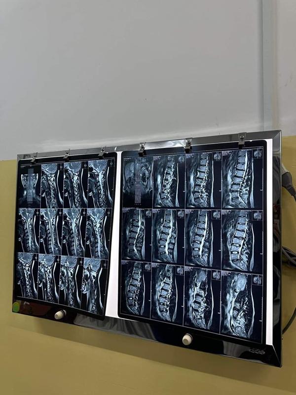 Sức khỏe báo động khiến Minh Tú chưa thể có em bé: Bị bệnh cột sống, thoái hóa và mất xương-3