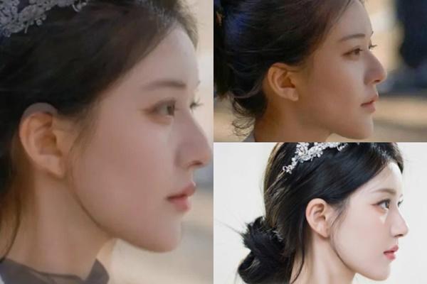 Triệu Lộ Tư lộ ảnh ngồi xe lăn nhập viện cấp cứu, khóa trang cá nhân nhiều ngày qua-5