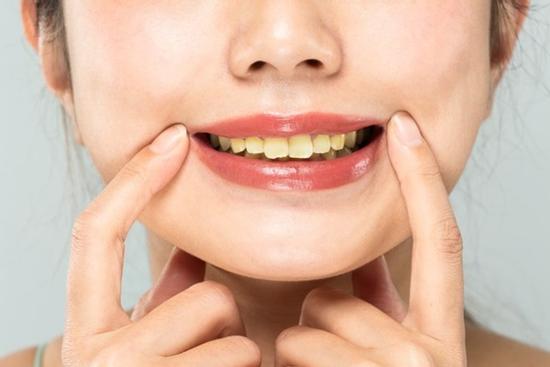 Có nên tẩy trắng răng bằng chanh?