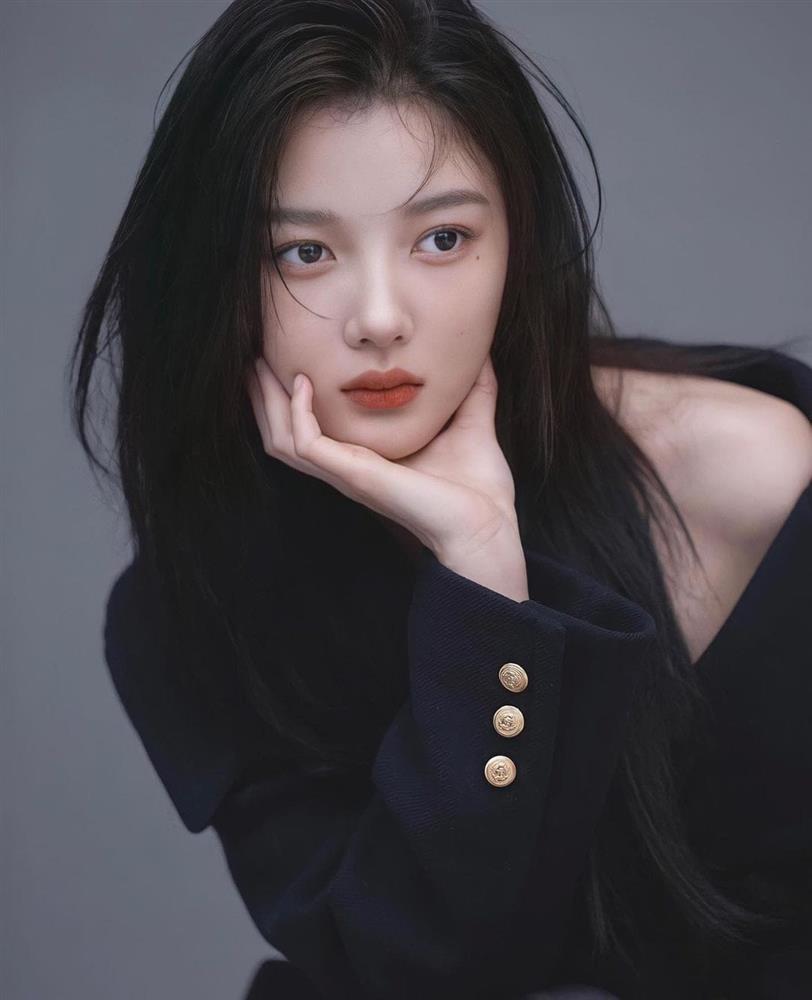 Bức ảnh xấu hổ nhất cuộc đời Kim Yoo Jung-1