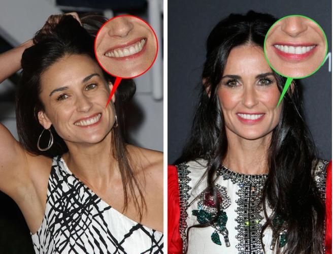 9 cách đơn giản để trông trẻ hơn tuổi thật không phải chị em nào cũng biết-4