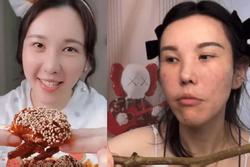 Mặt cô gái biến dạng sau 2 năm làm mukbang