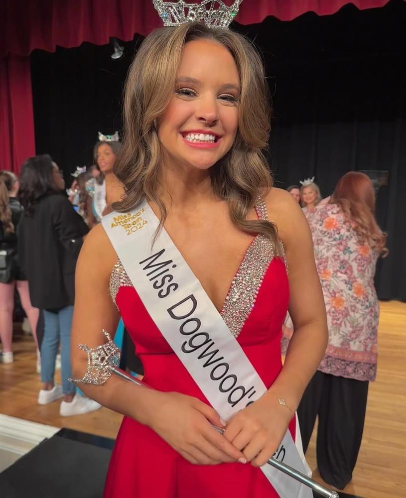 Tân Hoa hậu Tuổi teen Mỹ bị chê già-7