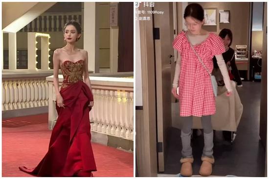 Triệu Lộ Tư và loạt mỹ nhân gây sốc vì gầy trơ xương