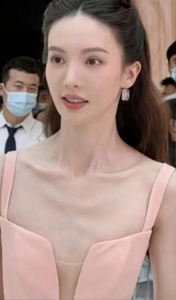 Phát hoảng với sao Hoa ngữ giảm cân quá đà: Người đột quỵ, người da bọc xương-3